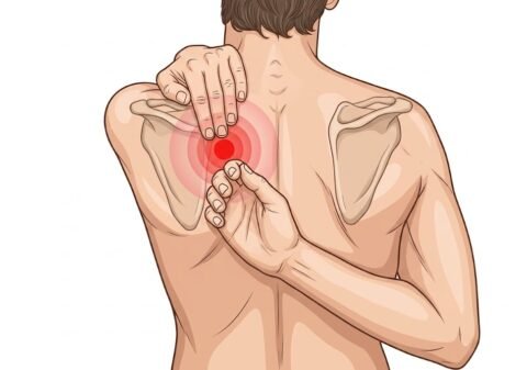 Can You Dislocate a Rib and How Would You Know